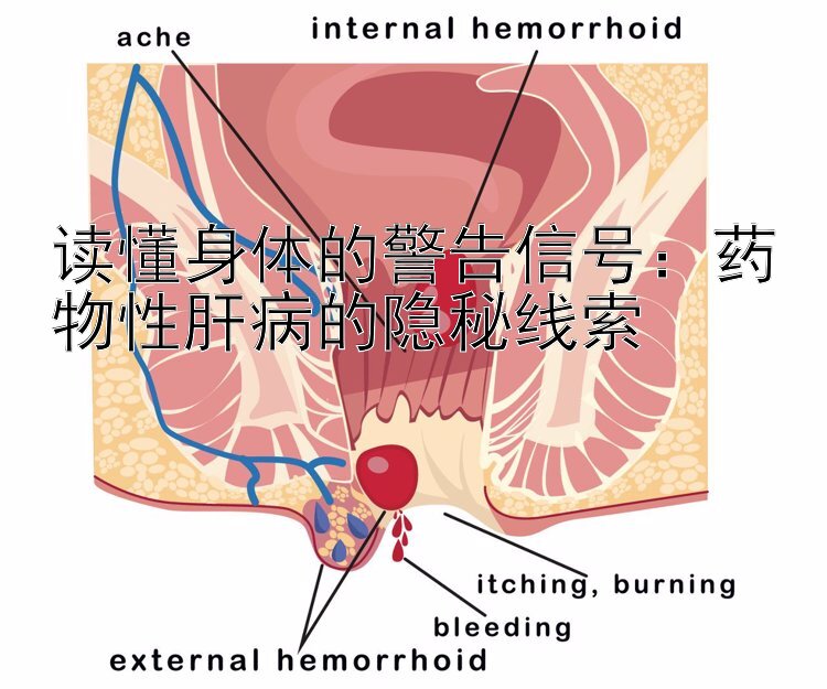 读懂身体的警告信号：药物性肝病的隐秘线索