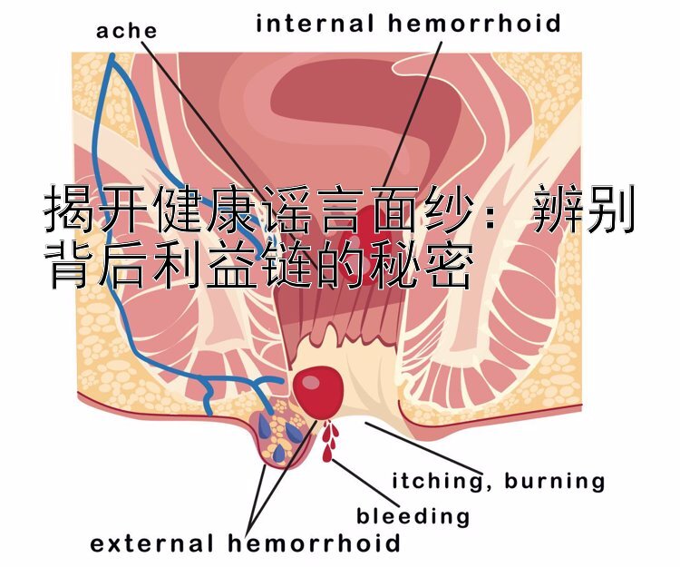 揭开健康谣言面纱：辨别背后利益链的秘密