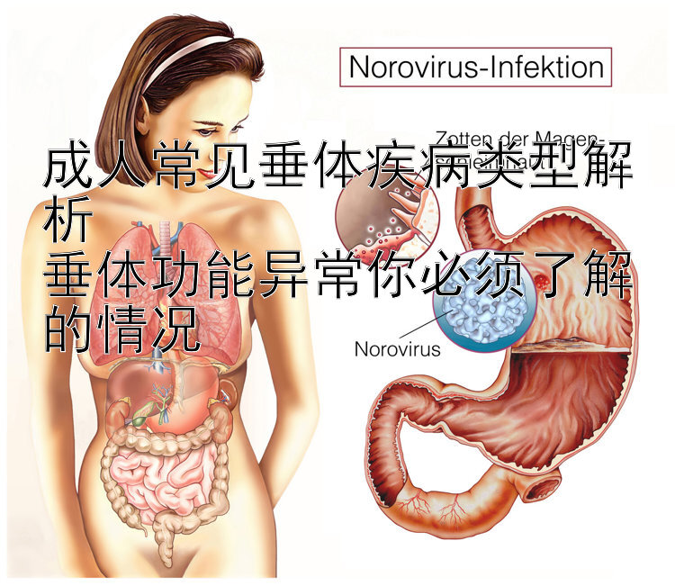 成人常见垂体疾病类型解析  
垂体功能异常你必须了解的情况