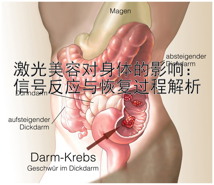 激光美容对身体的影响：信号反应与恢复过程解析