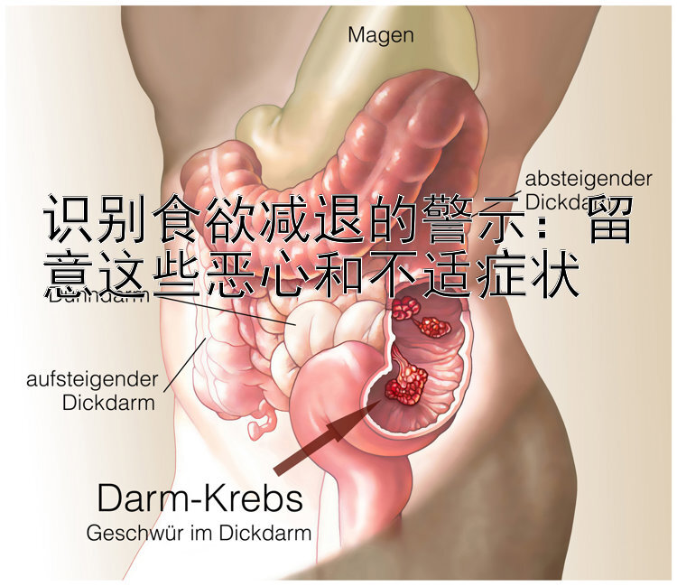 识别食欲减退的警示：留意这些恶心和不适症状