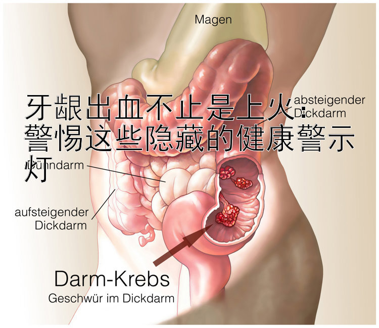 牙龈出血不止是上火：  
警惕这些隐藏的健康警示灯