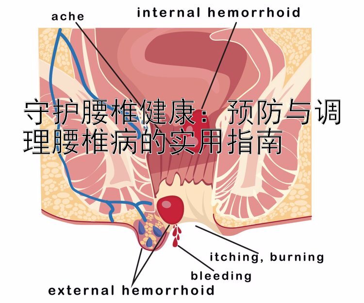 守护腰椎健康：预防与调理腰椎病的实用指南