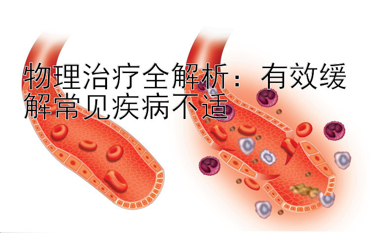 物理治疗全解析：有效缓解常见疾病不适