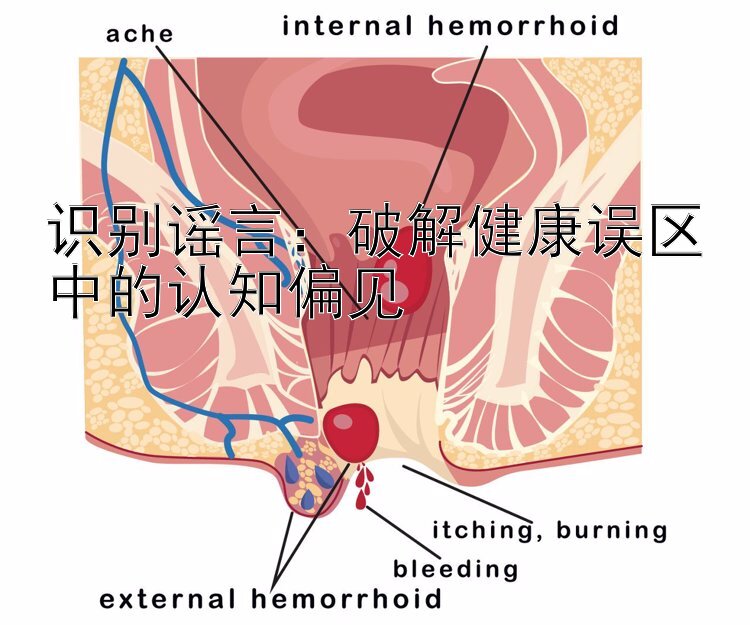 识别谣言：破解健康误区中的认知偏见