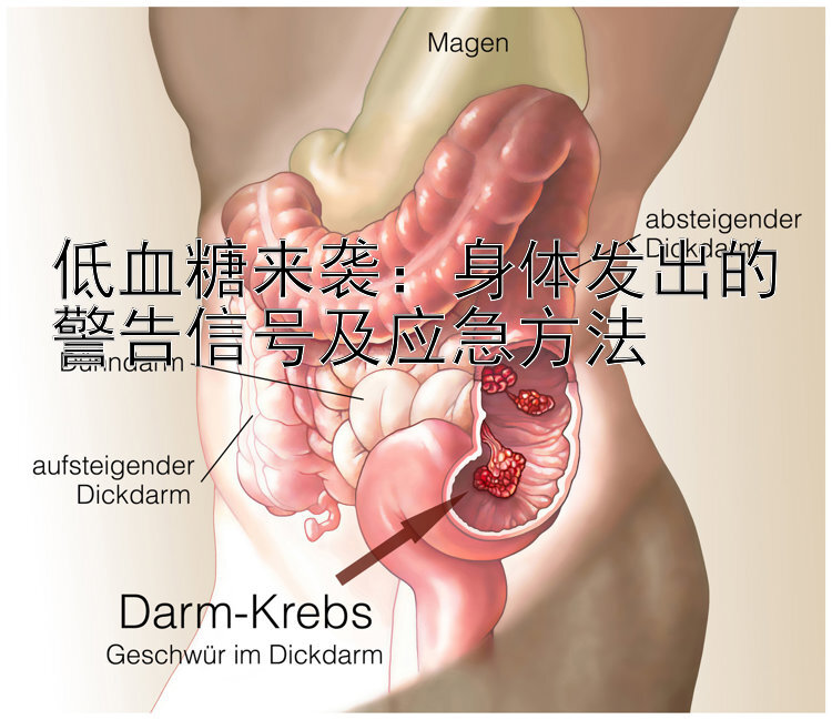 低血糖来袭：身体发出的警告信号及应急方法