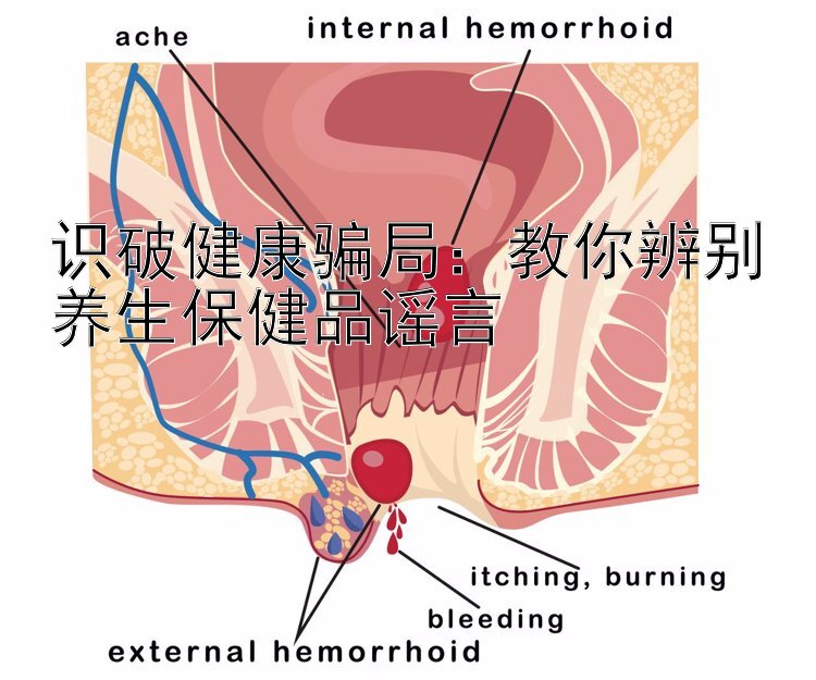 识破健康骗局：教你辨别养生保健品谣言