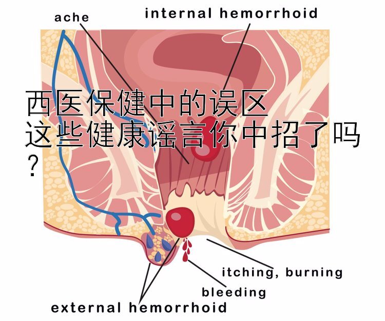 西医保健中的误区  
这些健康谣言你中招了吗？