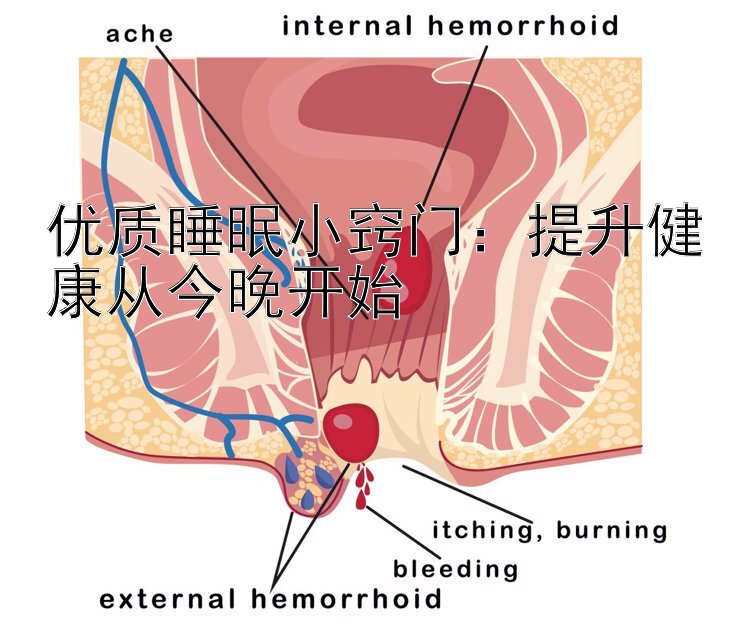 优质睡眠小窍门：提升健康从今晚开始