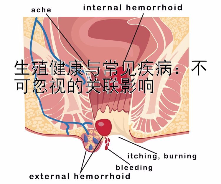 生殖健康与常见疾病：不可忽视的关联影响