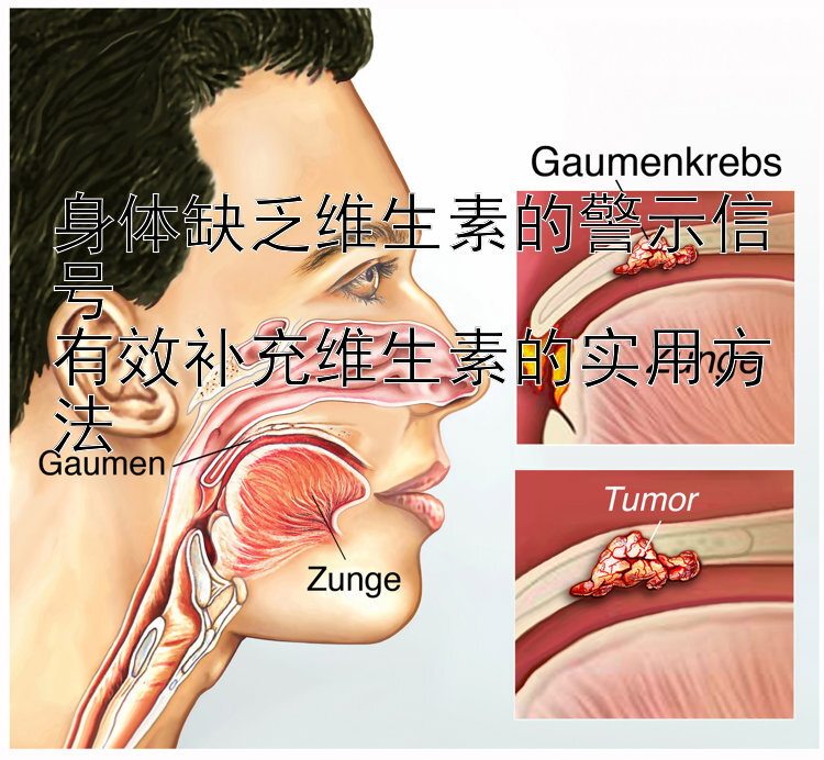 身体缺乏维生素的警示信号  
有效补充维生素的实用方法